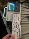 Strapping Atti to my EKG (1220654)