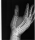 Broken Hand (264474)