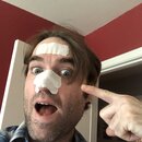 Blackhead Removal Experimentation (996150)