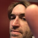 Blackhead Removal Experimentation (993332)