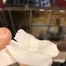 Blackhead Removal Experimentation (995998)