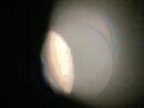 Telescope Moon Shots (1000082)