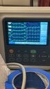 My Personal EKG (1165654)