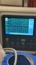 My Personal EKG (1171373)
